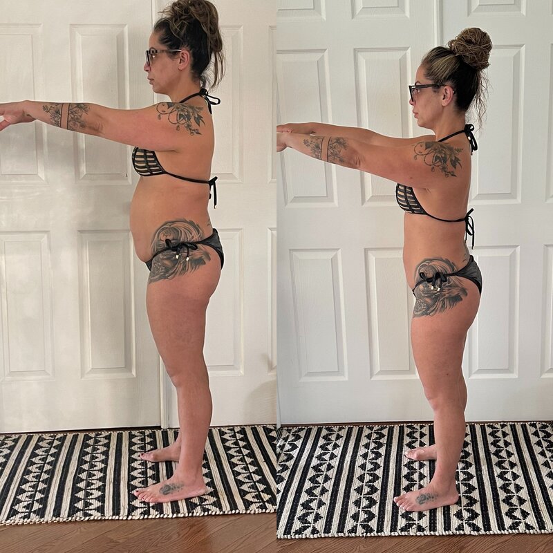 Before and after weight loss transformation at Refined Medical NY in East Setauket Long Island, showcasing results from medically assisted weight loss treatments like semaglutide, peptide therapy, or weight management services.