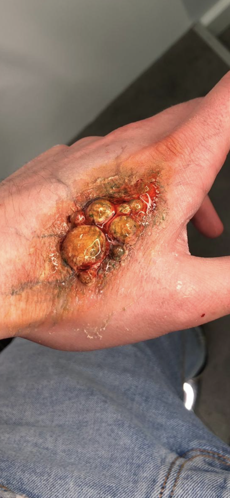 SFX Makeup on a Hand