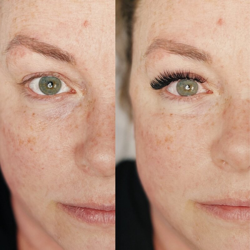 Side-by-side before and after image of classic lash extensions on freckled skin.