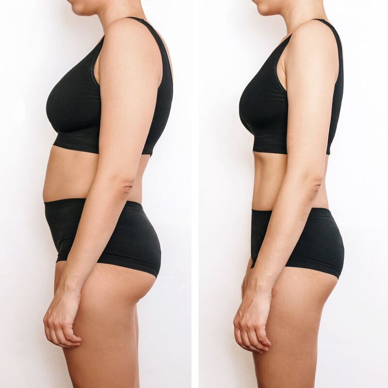 two-shots-young-woman-with-excess-fat-toned-slim-body-before-after-losing-weight