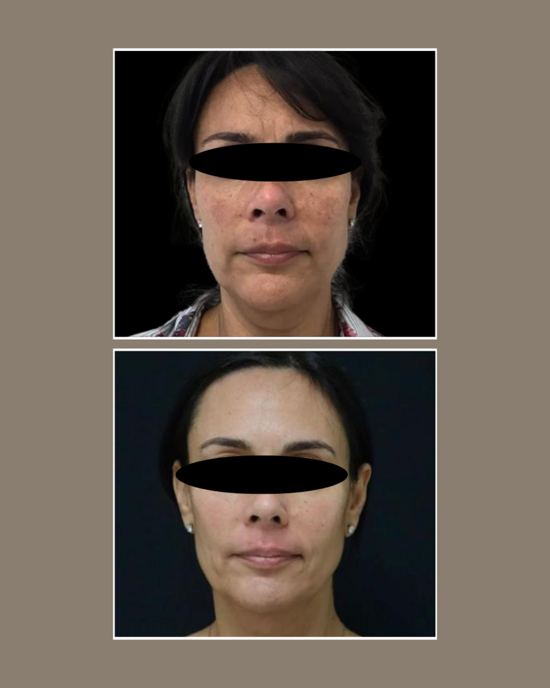 Skin Concerns - Glösense Dermatology and Aesthetics, Miami