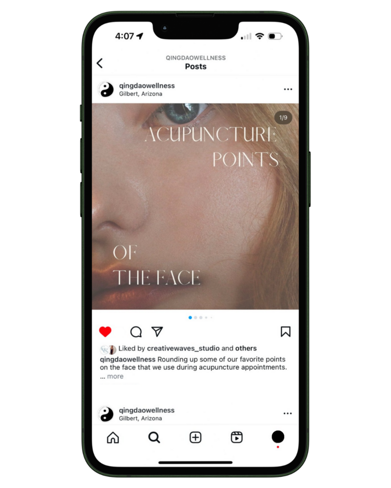 Acupunture social media, phoenix social media management, acupuncture social media management, wellness social media management