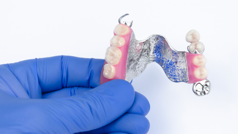 a dentist holds a Partial Denture