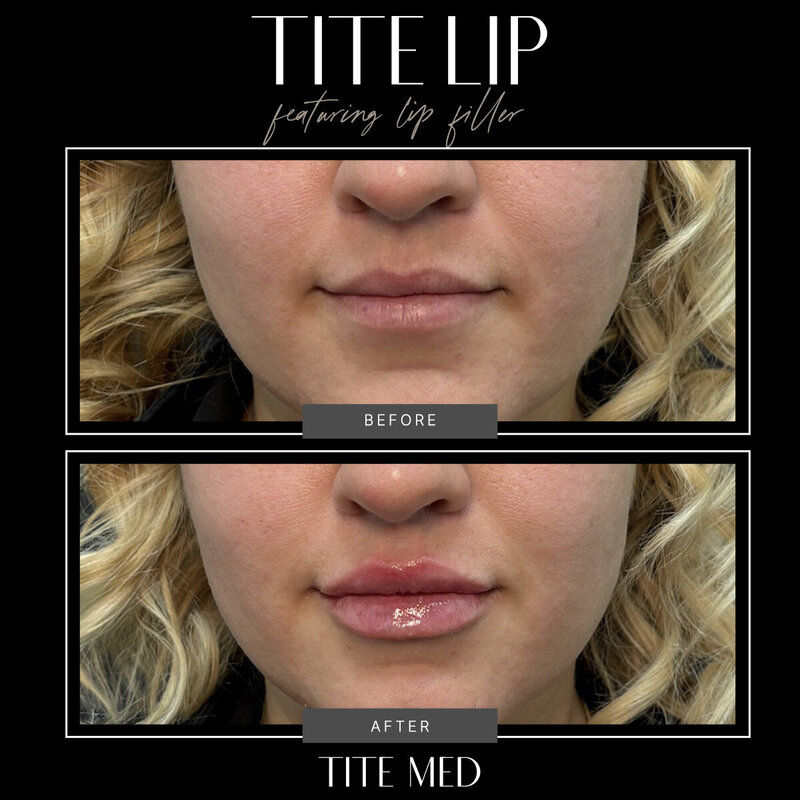TITE-BEFOREAFTER copy 2