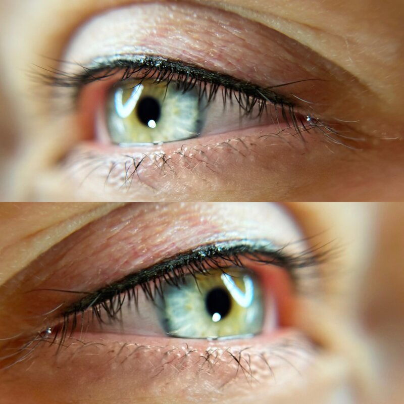 Liner Enhancement