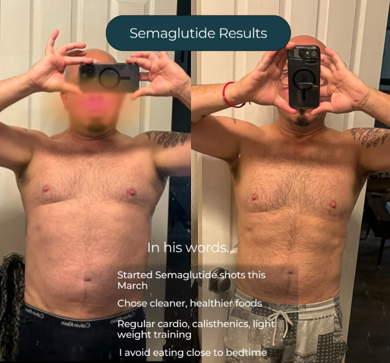 Semaglutide