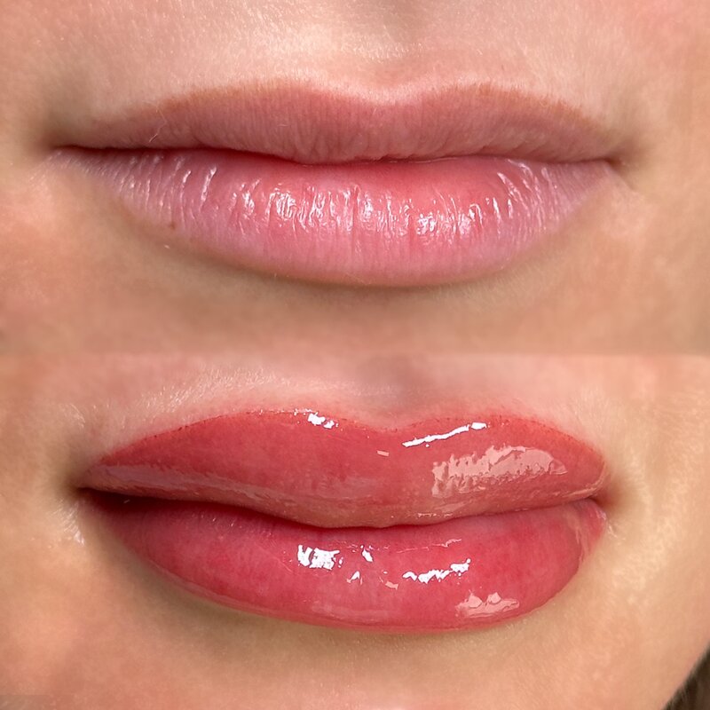 Facetune_16-01-2024-08-13-05