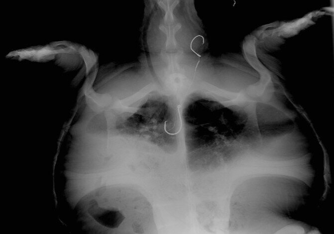 SNTU xray