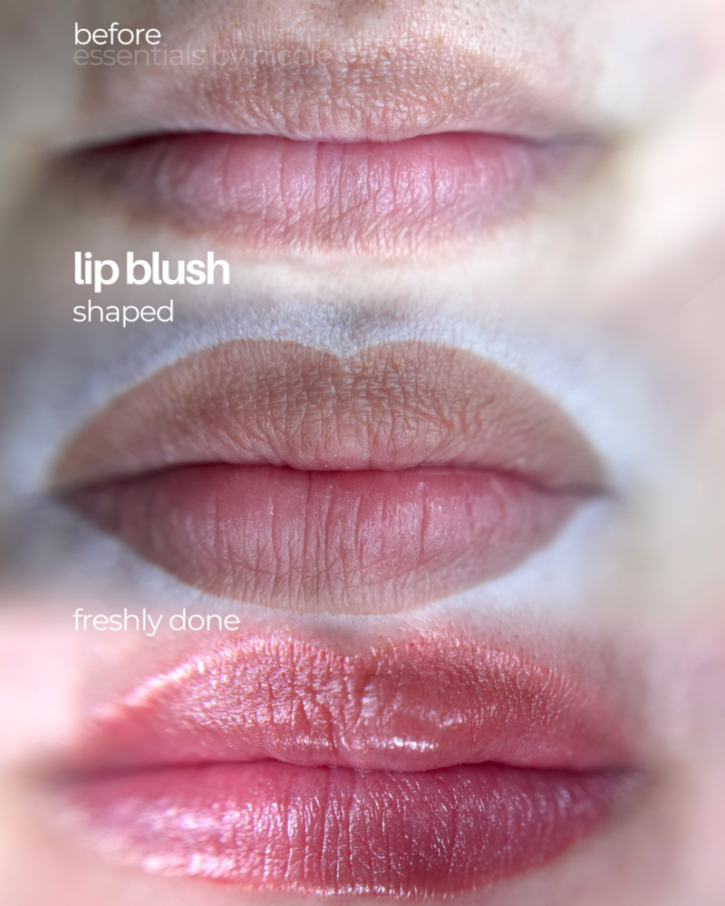 Dark lip neutralization before and after using permanent makeup techniques