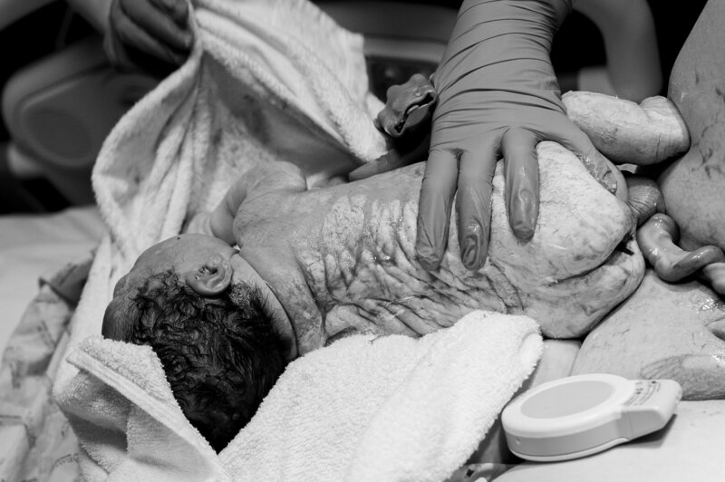 Black and white photo of newborn being lifted after birth — powerful storytelling Fort Worth birth photography by Poppy + Blue Photography