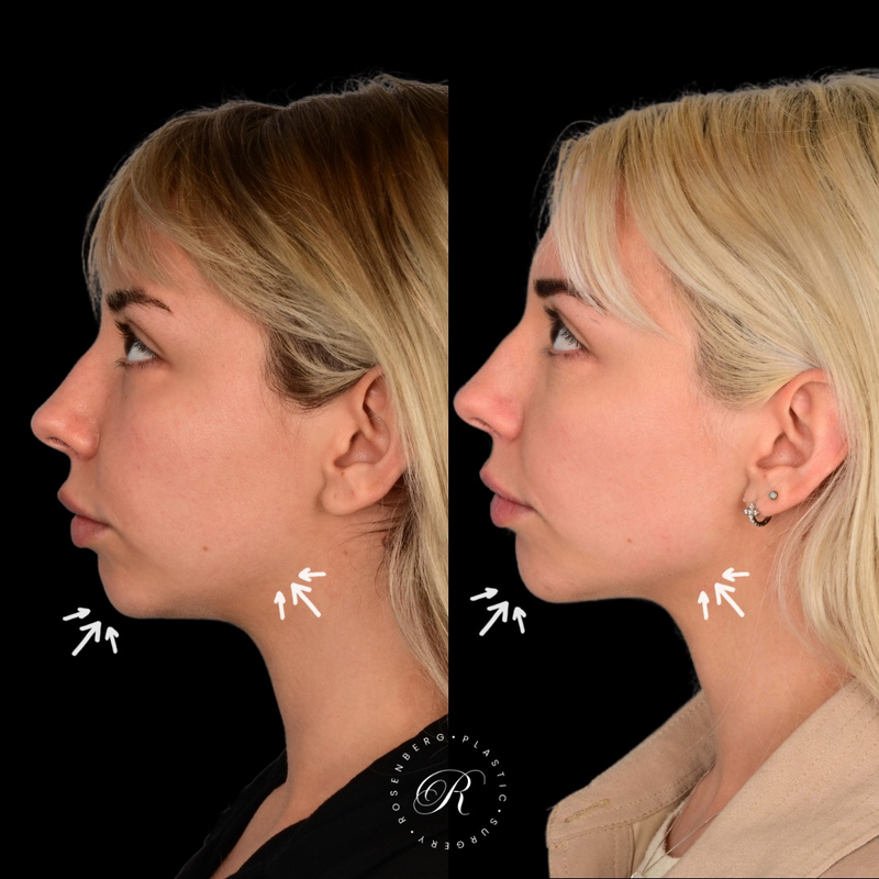 Copy of Copy of Template for Rosenberg Plastic Surgery B - 27