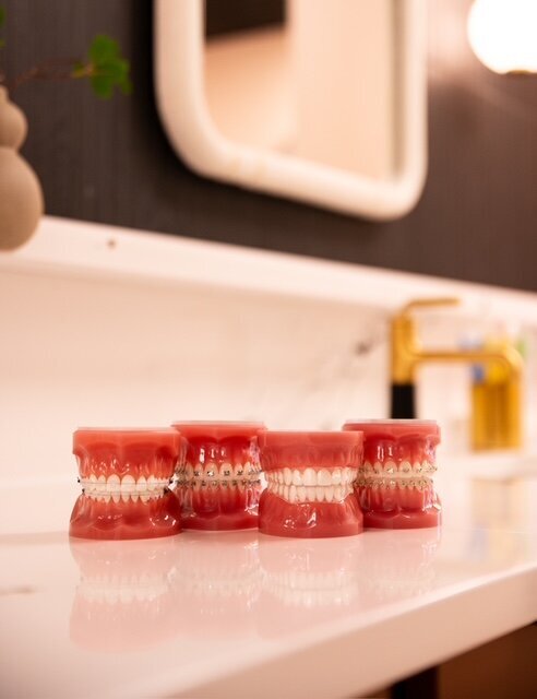 Braces models at Stewart Orthodontic Studio in Jonesboro AR