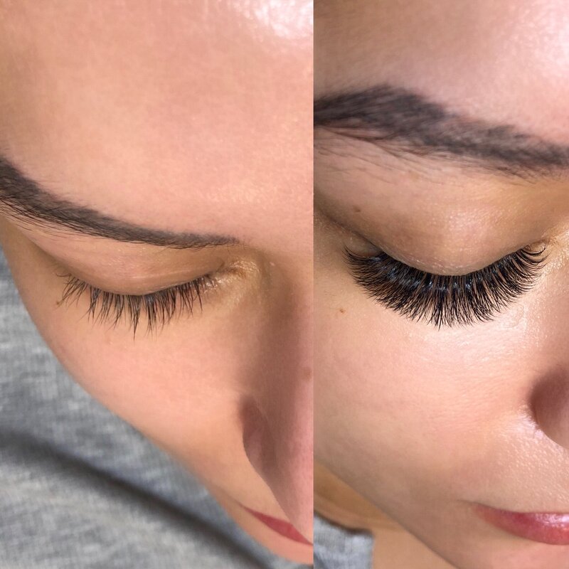 Before and after