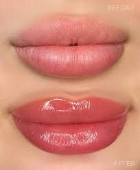 images (14)