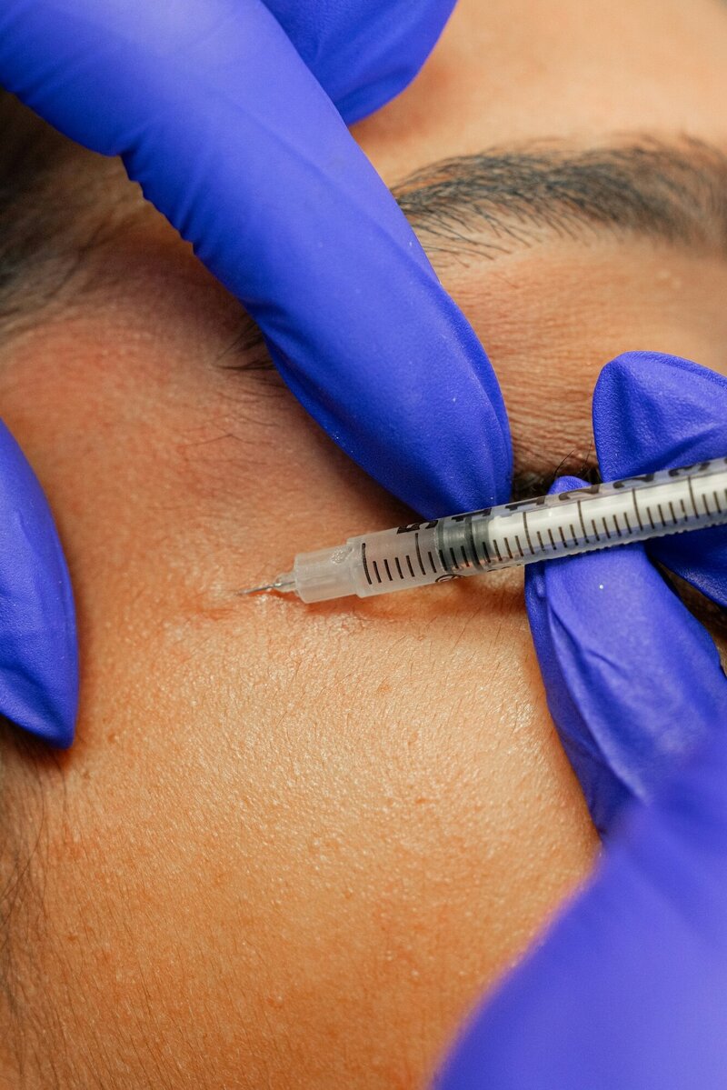 Botox being injected near the eye