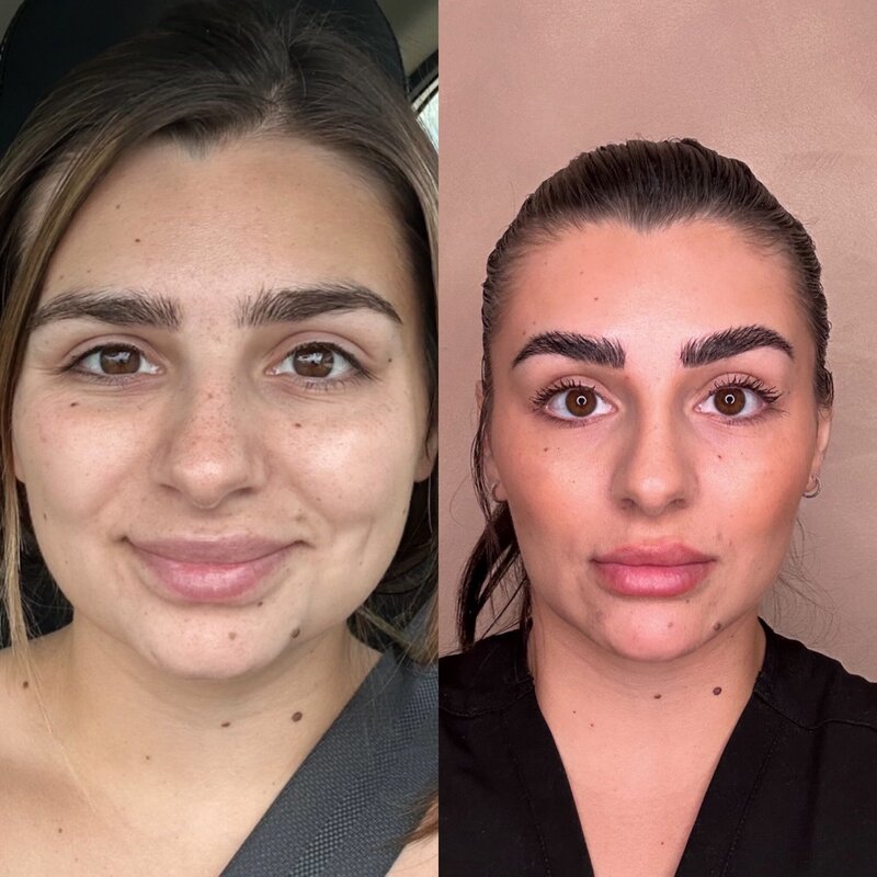 Facial balancing using dermal fillers and Botox at Luna Skin in Bryan TX to enhance symmetry and restore harmony