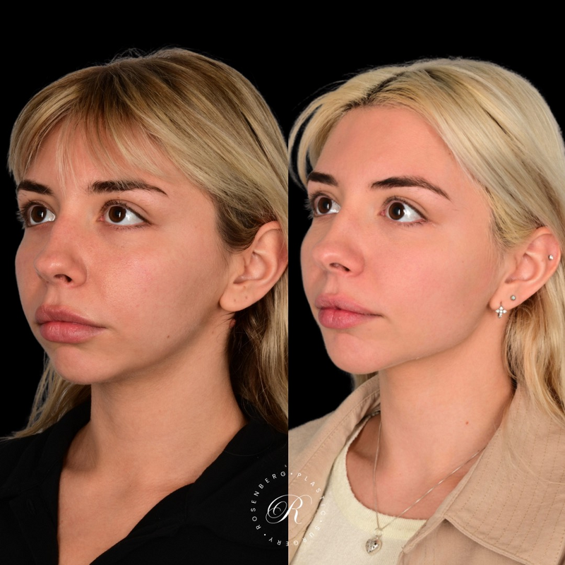 Copy of Copy of Template for Rosenberg Plastic Surgery B - 22