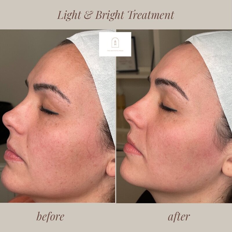 Medspa Treatments Kernersville