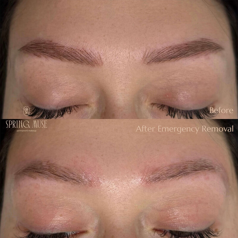 EMERGENCY PERMANENT MAKEUP REMOVAL NEW YORK