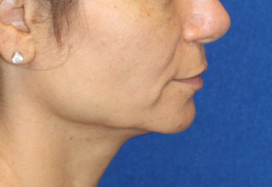 MedSpa Staff Looking At Camera
