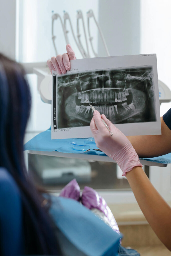 X-ray of teeth to fix cracks and chips in teeth and cavity fillings.