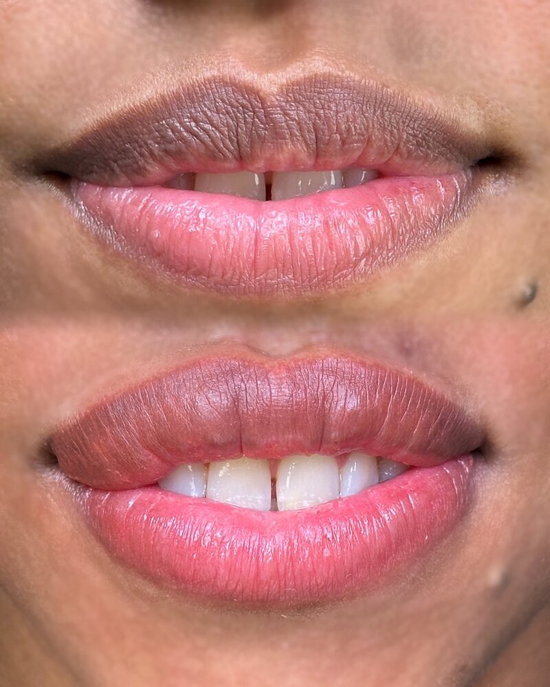 Facetune_11-12-2023-10-54-40