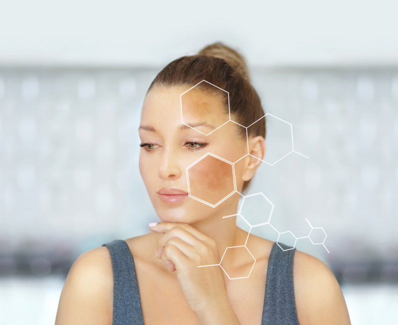 woman with her head turned towards her shoulder and her hand resting under her chin with melasma patches on her face and the structure of a chemical on top 