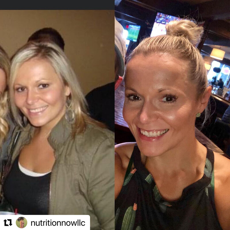 before and after