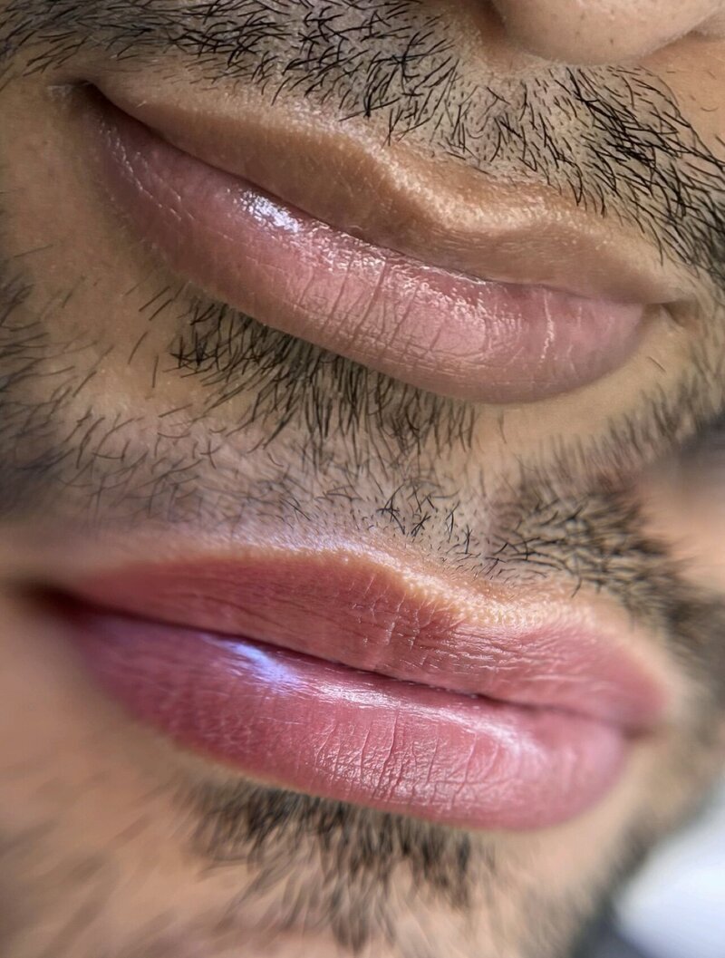 dark lips neutralization in New York