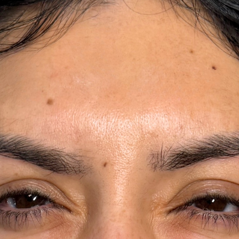 28