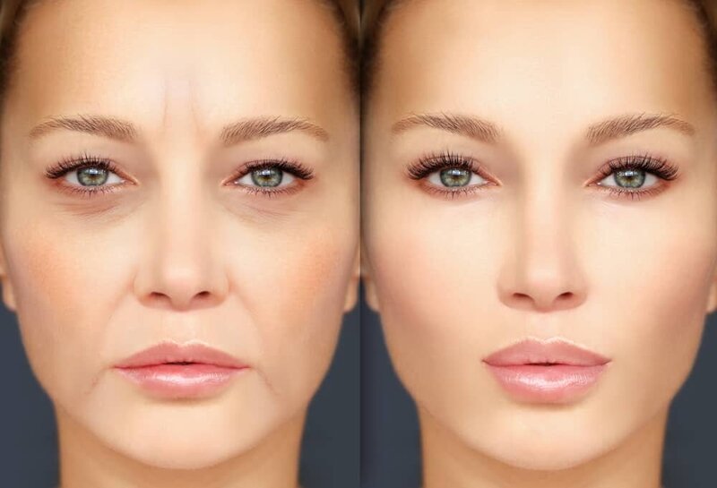 before and after compressed