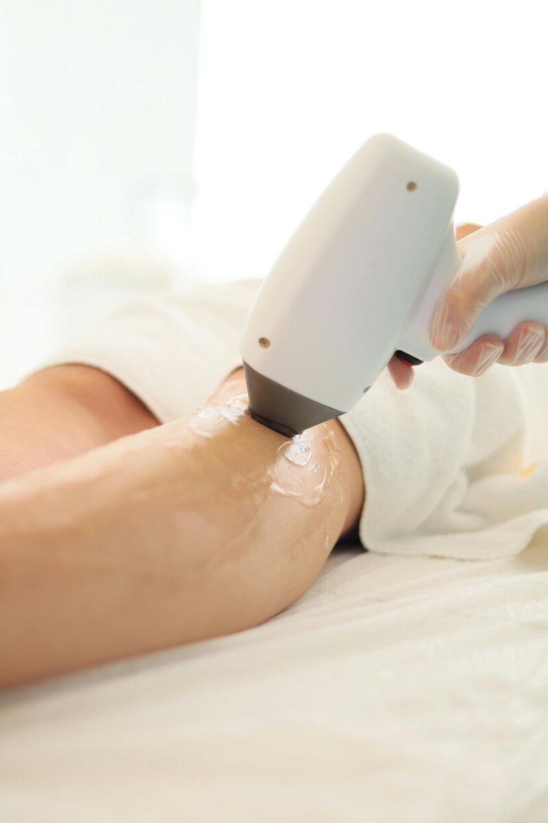laser ontharing actie
