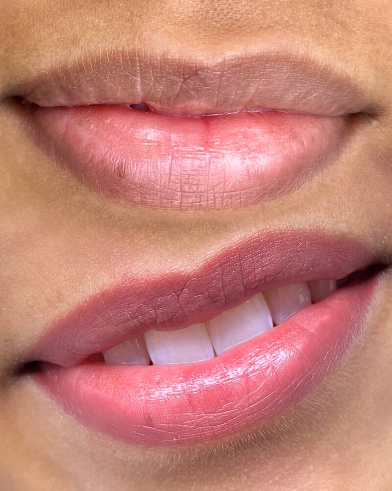 dark lips neutralization in New York