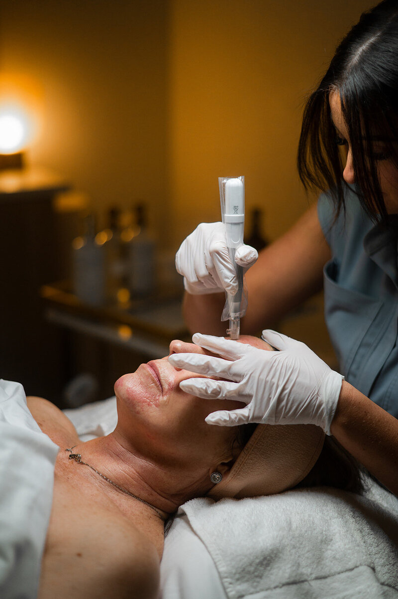 Microneedling