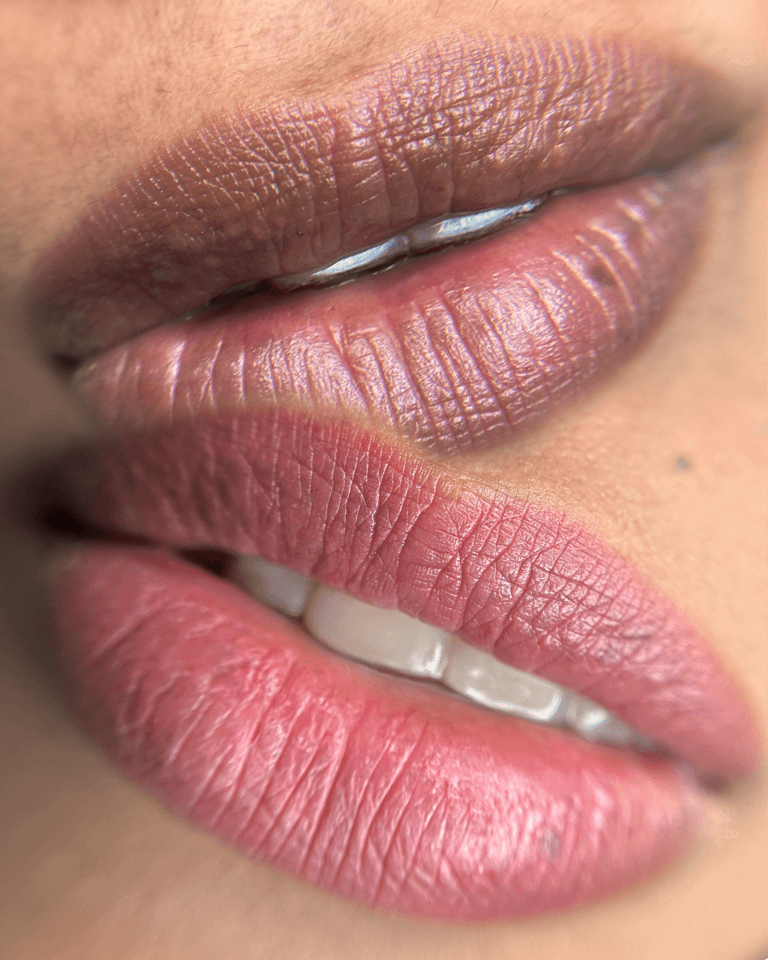 dark lips neutralization in New York