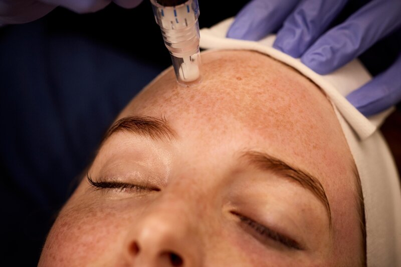 Botox Near Me in Jacksonville, FL