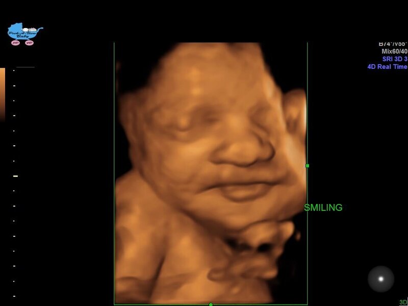 Peek-A-View Baby 3D/4D Ultrasound Pricing and Packages