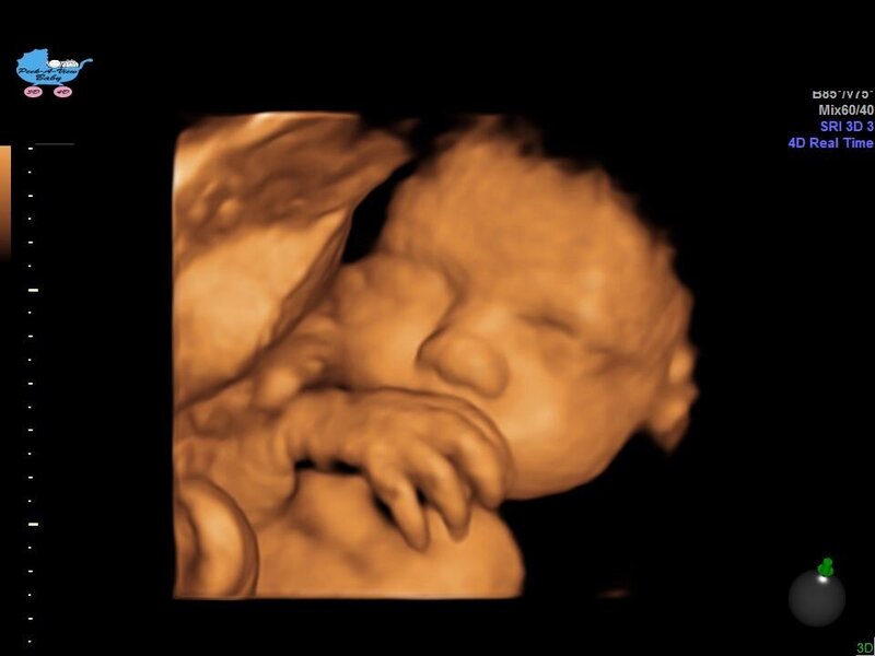 Peek-A-View Baby 3D/4D Ultrasound Home Page