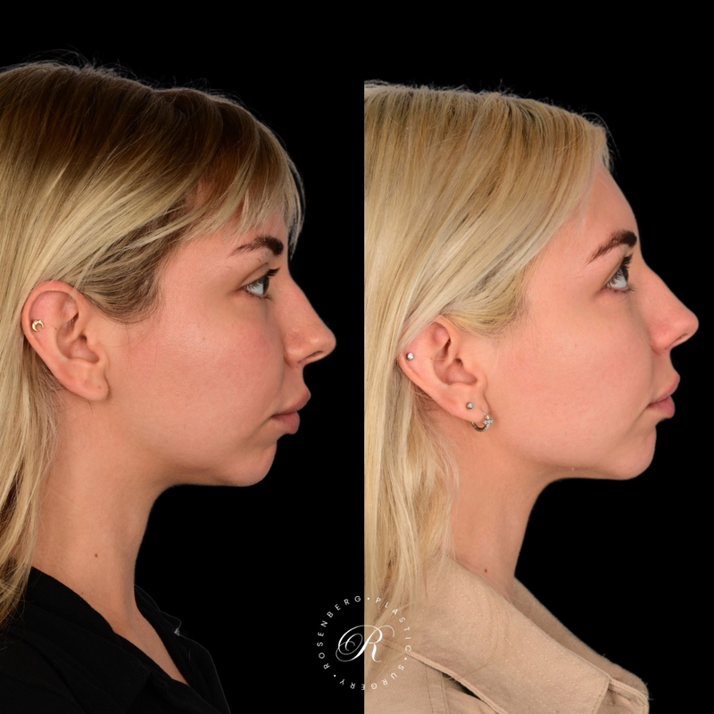 Copy of Copy of Template for Rosenberg Plastic Surgery B - 24