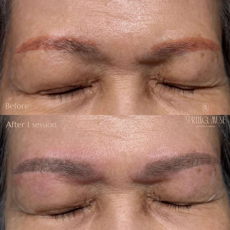 Red brows after PMU? We can remove them. NYC