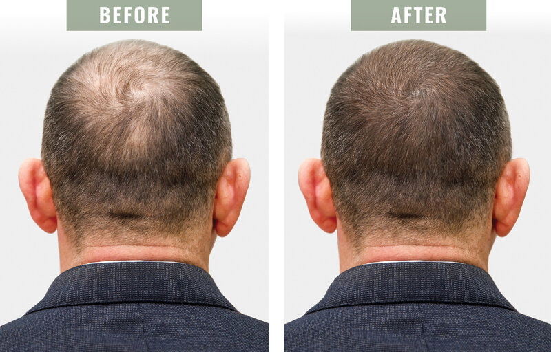 BeforeandAfter_WhiteMale
