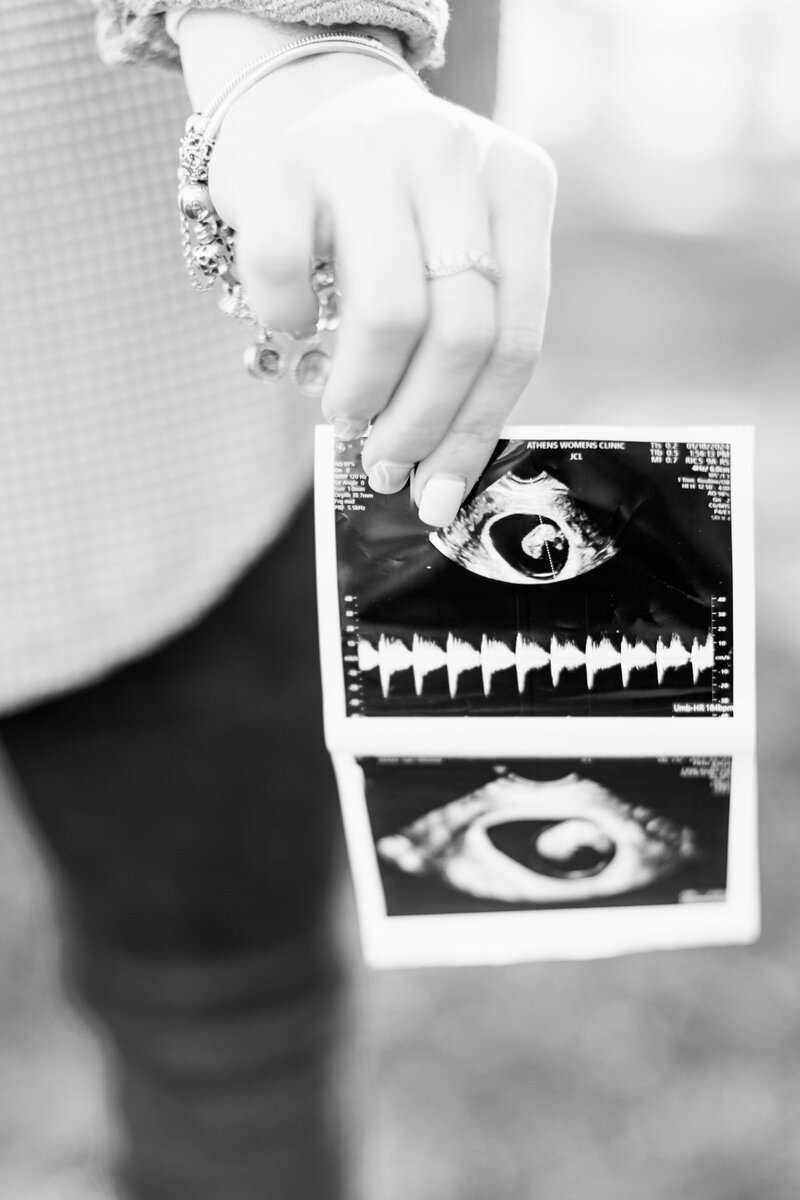 close up of a pregnancy sonogram