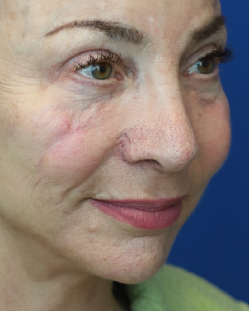 MedSpa Staff Looking At Camera
