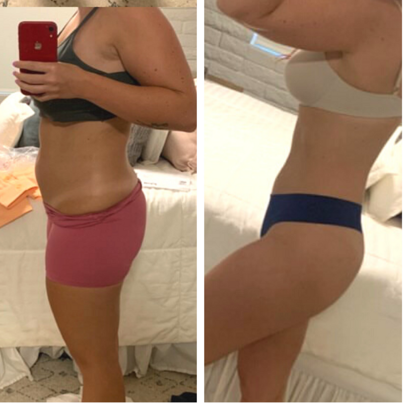 Before and after template_3FORMA Results-04