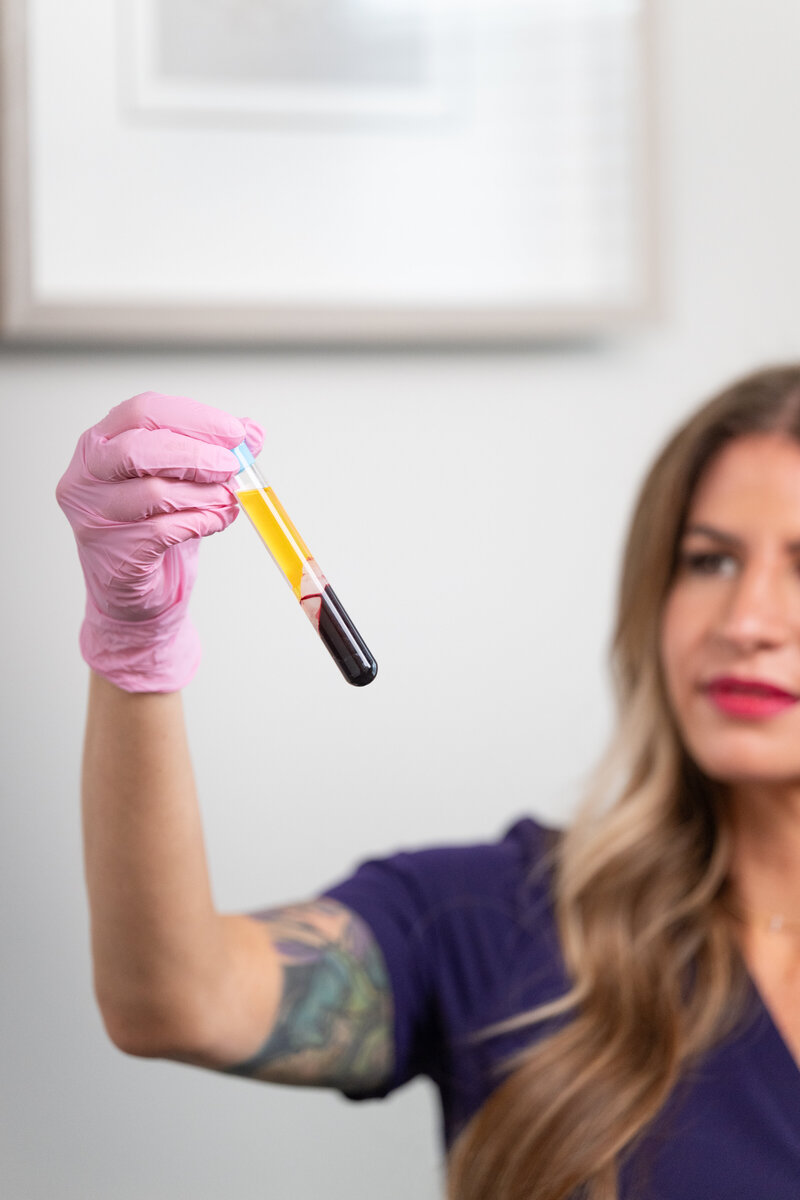 PRP and PRF at Anacortes Health & Aesthetics