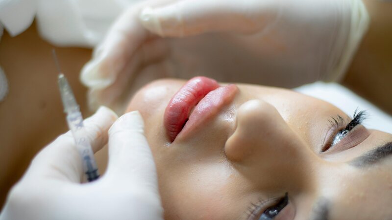 woman getting lip injections from specialist