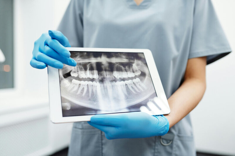 Dentist pointing at an x-ray to show where they are replacing a tooth for a dental implant.