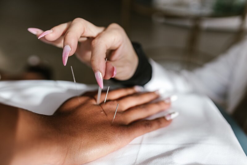 Acupuncture practitioner in the Sayulita and San Pancho areas of Nayarit, Mexico