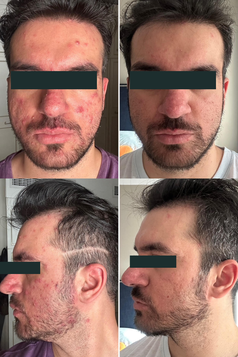 Katie Stewart The clear skin solution Nutritionist