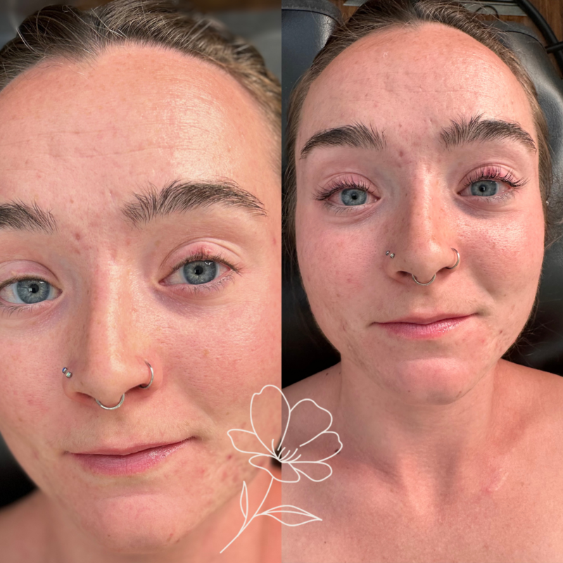 wildroots before+after (2)